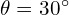 \theta = 30^\circ